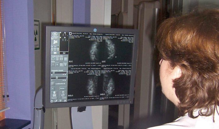 El programa de cribado de cáncer de mama de la Junta detecta 1.983 casos desde enero de 2023