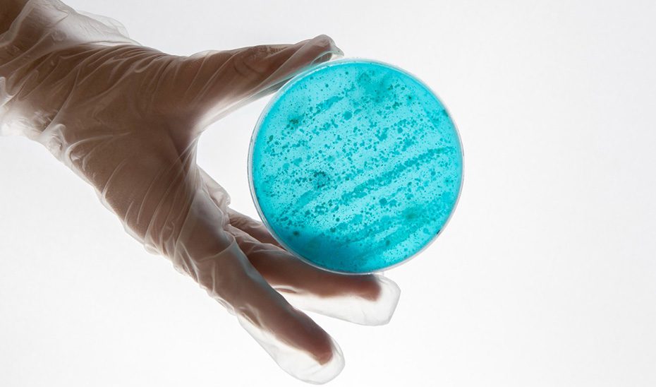 Andalucía intensifica las medidas frente al sarampión tras la detección de 47 casos