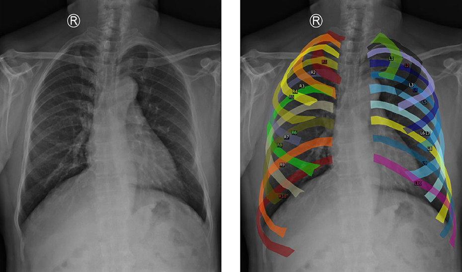 Investigadores andaluces desarrollan un modelo inteligente que facilita el diagnóstico temprano de enfermedades pulmonares